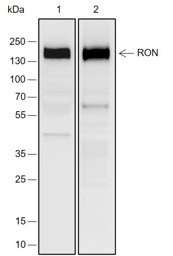 Recombinant RON Monoclonal Antibody (AN302001L)