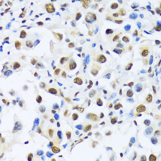 OTP Polyclonal Antibody (E-AB-64494)