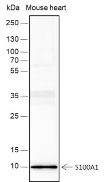 Recombinant S100A1 Monoclonal Antibody (AN301707L)