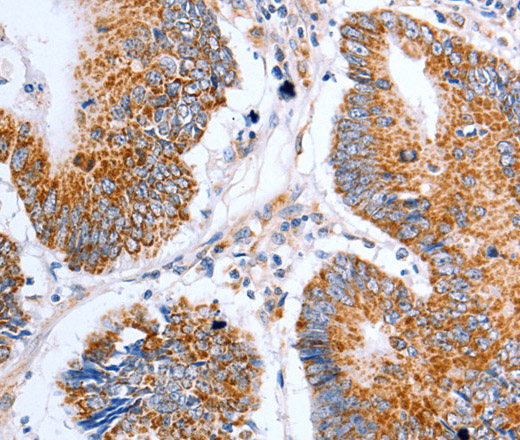 Claudin 10 Polyclonal Antibody (E-AB-12459)