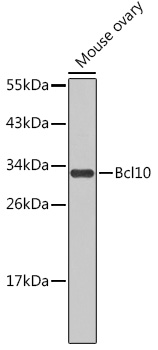 Bcl10 Polyclonal Antibody (E-AB-90009)