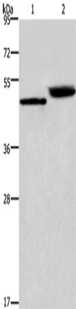 Cathepsin E Polyclonal Antibody (E-AB-10209)