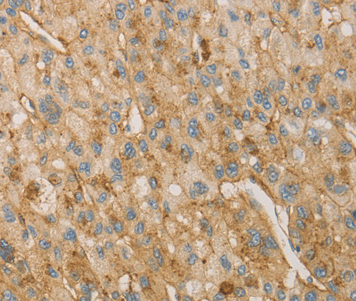 VTN Polyclonal Antibody (E-AB-14685)