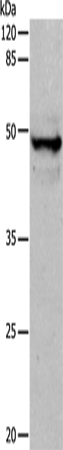 CK-15 Polyclonal Antibody (E-AB-13910)