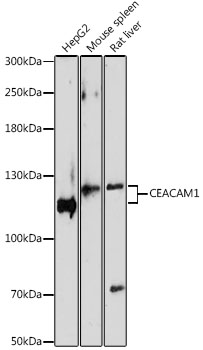 CEACAM1 Polyclonal Antibody (E-AB-60416)