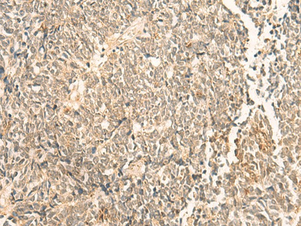 NIP7 Polyclonal Antibody (E-AB-18921)