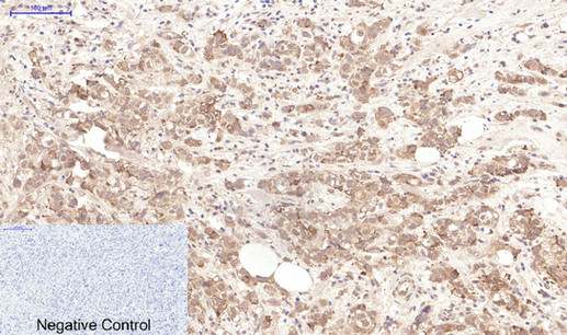 LTF Monoclonal Antibody (E-AB-22104)