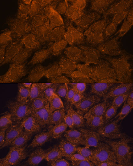 TNFAIP8L2 Polyclonal Antibody (E-AB-64797)