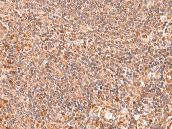 RABEPK Polyclonal Antibody (E-AB-19004)
