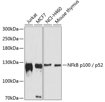 NFkB p100 / p52 Polyclonal Antibody (E-AB-65807)