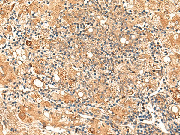GALNT12 Polyclonal Antibody (E-AB-52869)