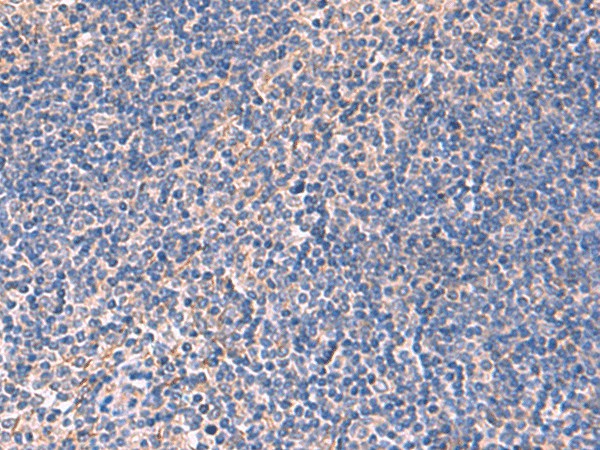 INPP5B Polyclonal Antibody (E-AB-52025)