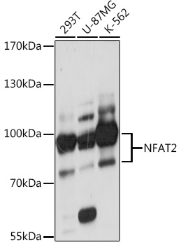 NFAT2 Polyclonal Antibody (E-AB-93184)