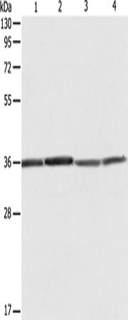 RPLP0 Polyclonal Antibody (E-AB-14335)