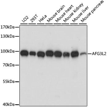 AFG3L2 Polyclonal Antibody (E-AB-65299)
