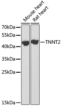 TNNT2 Polyclonal Antibody (E-AB-60197)
