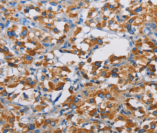 TSPEAR Polyclonal Antibody (E-AB-14717)