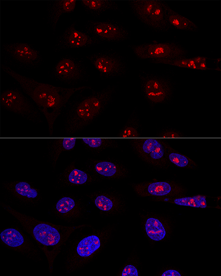 NOP58 Polyclonal Antibody (E-AB-64937)