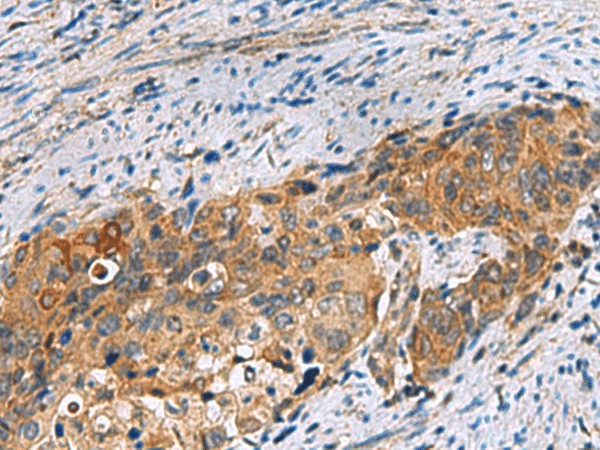 JOSD1 Polyclonal Antibody (E-AB-19165)