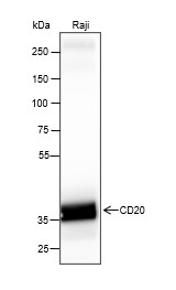 Recombinant CD20 Monoclonal Antibody (AN301470L)