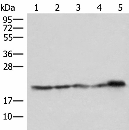 ATP5PD Polyclonal Antibody (E-AB-52881)