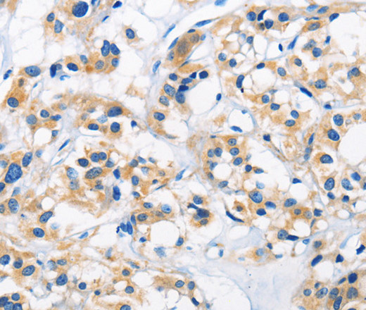 HK1 Polyclonal Antibody (E-AB-10930)
