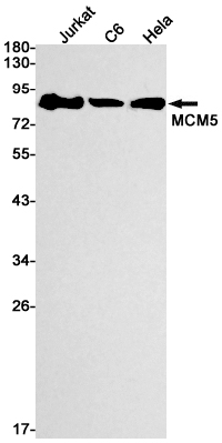 Recombinant MCM5 Monoclonal Antibody (E-AB-81429)