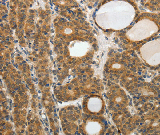 RARA Polyclonal Antibody (E-AB-10577)