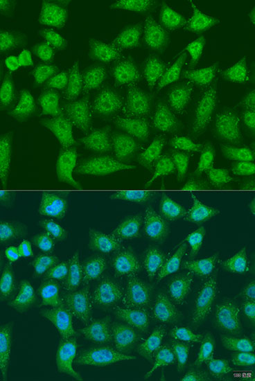EGLN3 Polyclonal Antibody (E-AB-67937)