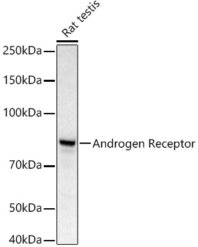 Androgen Receptor Polyclonal Antibody (E-AB-68340)