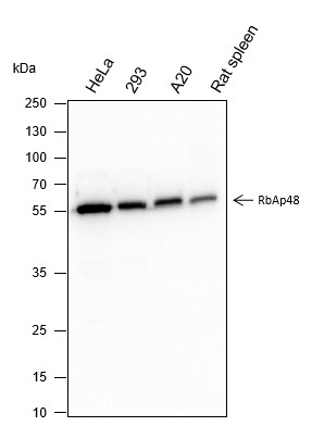Recombinant RBBP4 Monoclonal Antibody (AN301648L)