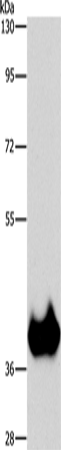 ASPA Polyclonal Antibody (E-AB-14754)
