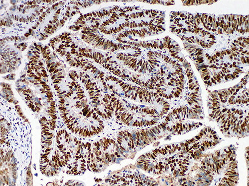 MSH6 Monoclonal Antibody (ELAB6196-M)