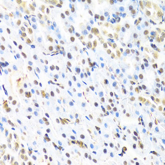 RUNX1 Polyclonal Antibody (E-AB-60579)