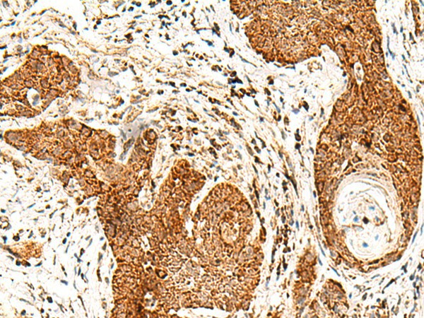SMOC1 Polyclonal Antibody (E-AB-18835)