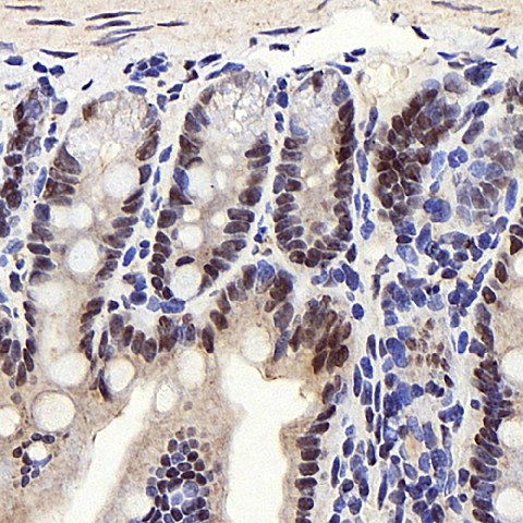 PPARA Polyclonal Antibody (E-AB-70253)