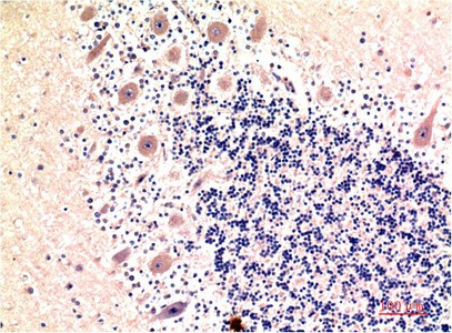MAP1LC3B Monoclonal Antibody (E-AB-22132)