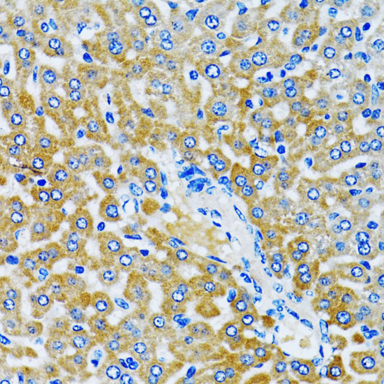 HDAC5 Polyclonal Antibody (E-AB-63255)