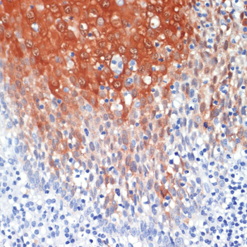 S100A8 Polyclonal Antibody (E-AB-65264)