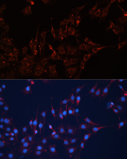 GNAI2 Polyclonal Antibody (E-AB-66306)