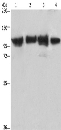 ACTN4 Polyclonal Antibody (E-AB-14759)