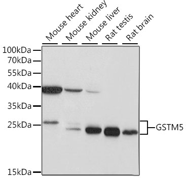 GSTM5 Polyclonal Antibody (E-AB-91241)