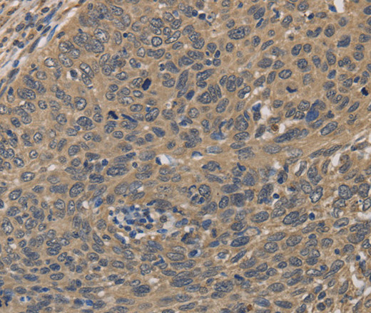 HSF1 Polyclonal Antibody (E-AB-10374)