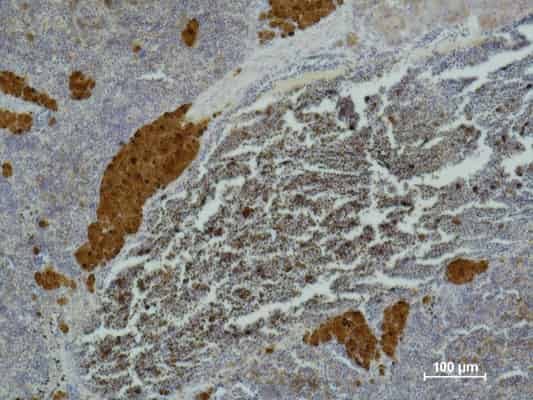 IL2RA Monoclonal Antibody (E-AB-22102)