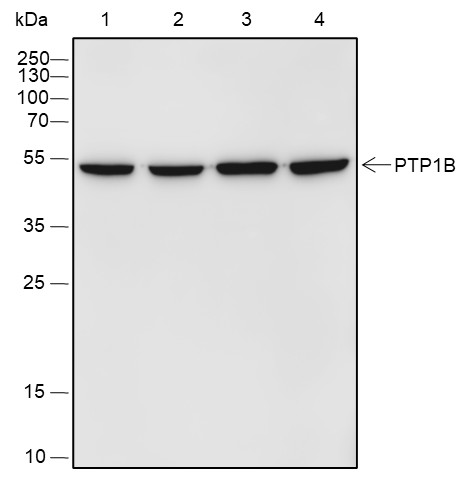 Recombinant PTP1B Monoclonal Antibody (AN301798L)