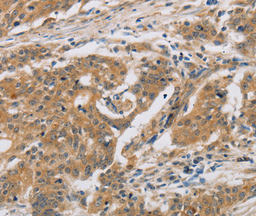 CST6 Polyclonal Antibody (E-AB-11131)