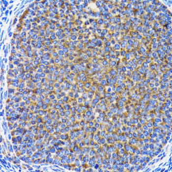 MAP1LC3A Polyclonal Antibody (E-AB-63532)