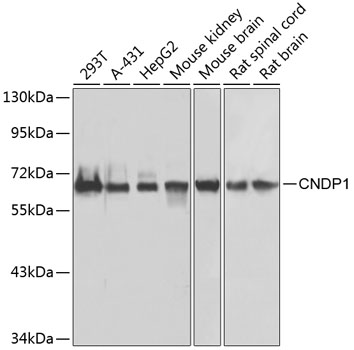 CNDP1 Polyclonal Antibody (E-AB-61740)