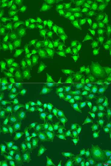 RSAD2 Polyclonal Antibody (E-AB-65580)