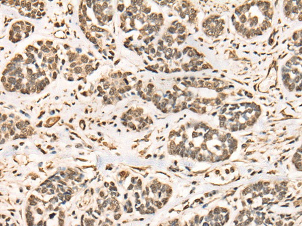 BRD7 Polyclonal Antibody (E-AB-52477)